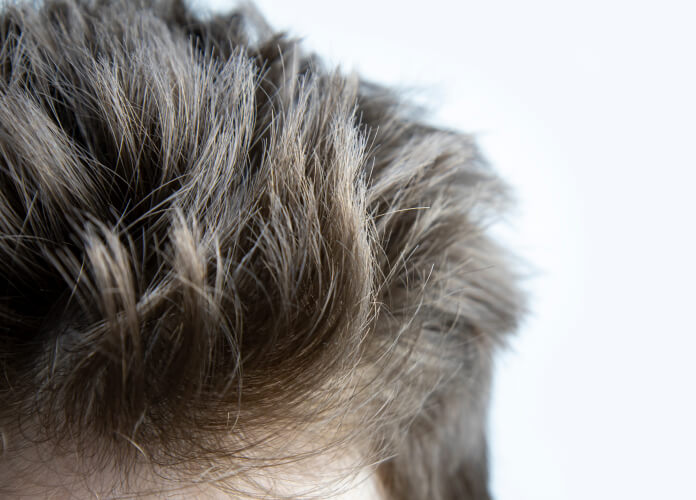 Hair